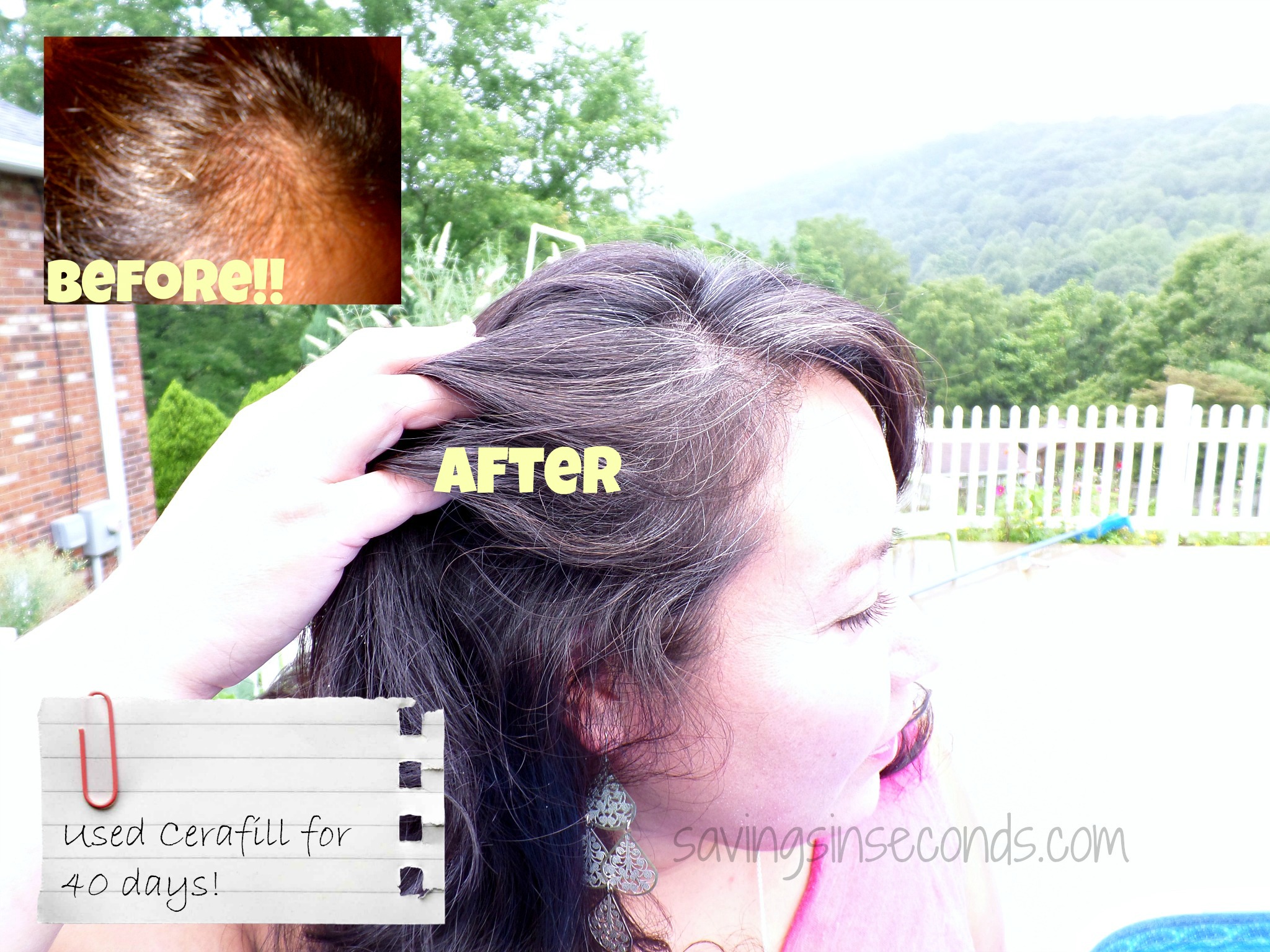 thinning hair post-baby or due to heredity? try #cerafill